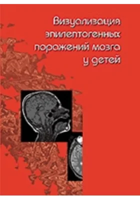 Визуализация эпилептогенных поражений мозга у детей