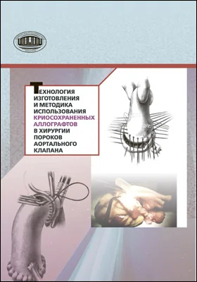 Технология изготовления и методика использования криосохраненных аллографтов в хирургии пороков аортального клапана